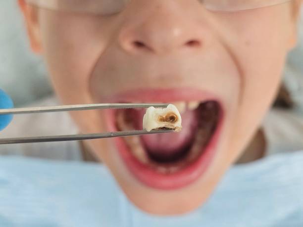 Best Emergency Pediatric Dental Care in Hartley, IA